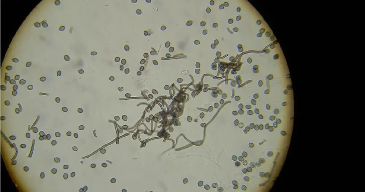 Chaetomium spores